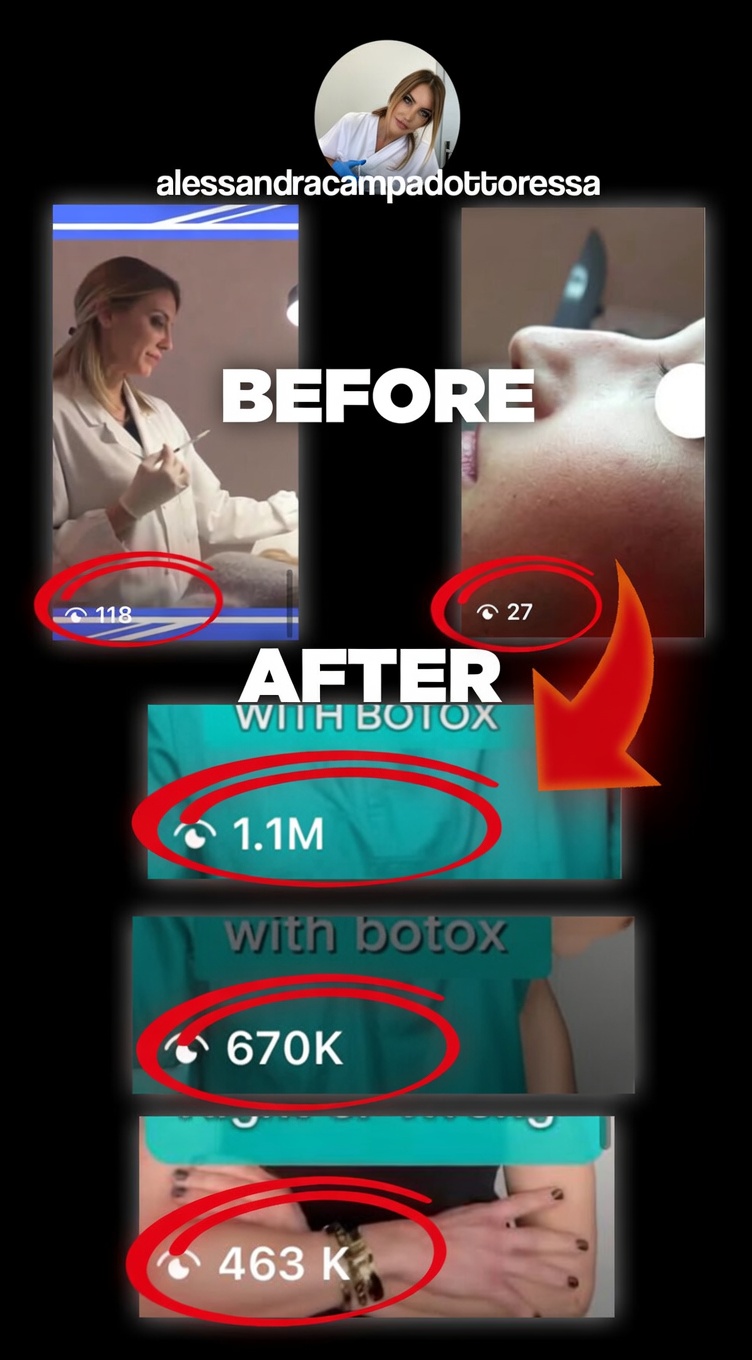 Alessandra — before/after content views: from 118 and 27 views to 1.1M, 670K and 463K